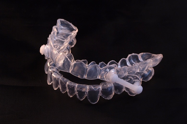 Close-up of oral appliance for treating sleep apnea in Edmonton, AB